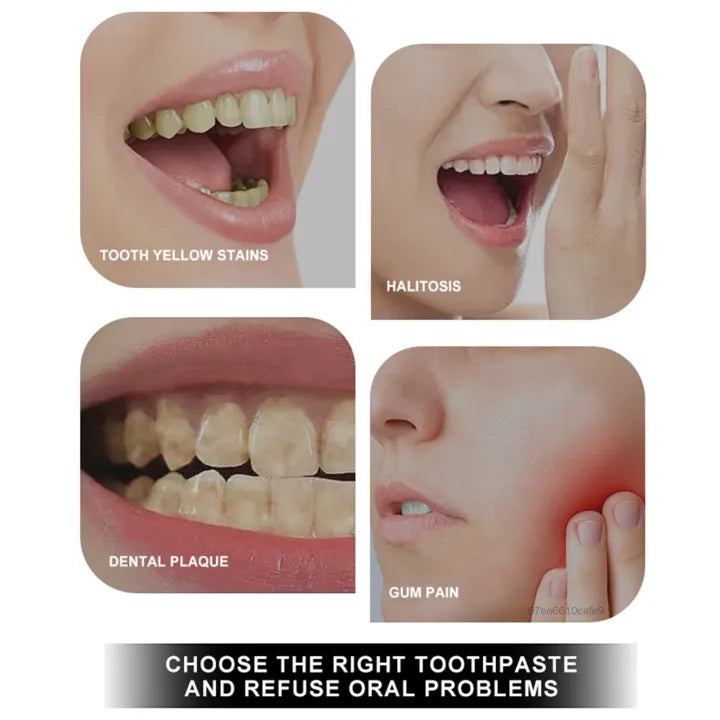 Nano Hydroxyapatite Toothpaste – Enamel Repair & Sensitivity Care (120g)