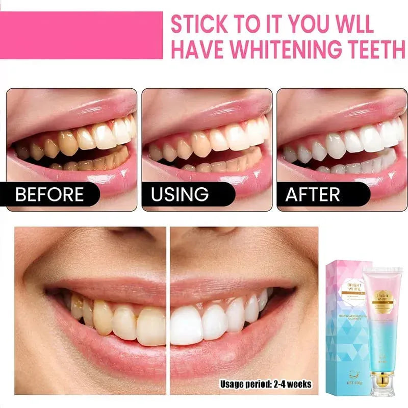 Teeth whitening before and after photos showing gradual brightening over 2-4 weeks with whitening gel