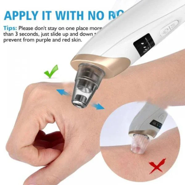 Electric suction blackhead remover used on skin, pore cleaner beauty tool at sunehri store